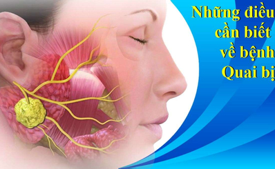 Những điều cần biết về bệnh Quai bị